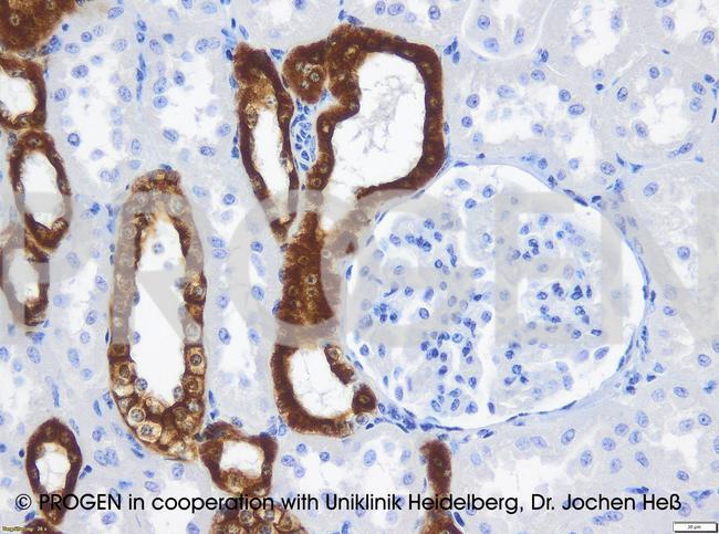 Cytokeratin 18 Antibody in Immunohistochemistry (IHC)