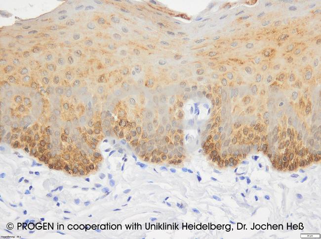 Cytokeratin 19 Antibody in Immunohistochemistry (IHC)