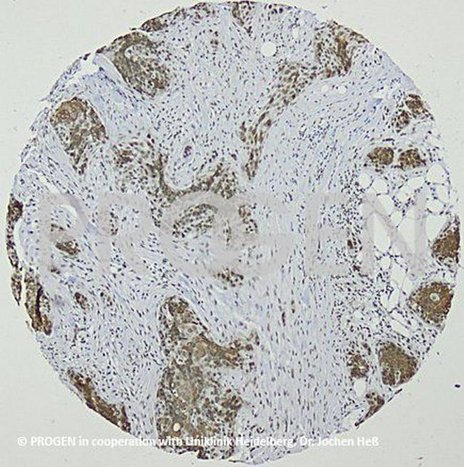 Cytokeratin 19 Antibody in Immunohistochemistry (IHC)