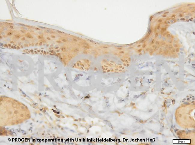 Cytokeratin 17 Antibody in Immunohistochemistry (IHC)