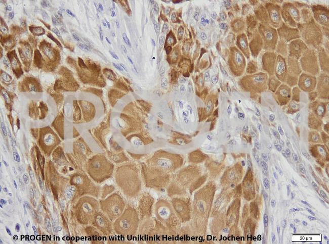 Cytokeratin 17 Antibody in Immunohistochemistry (IHC)