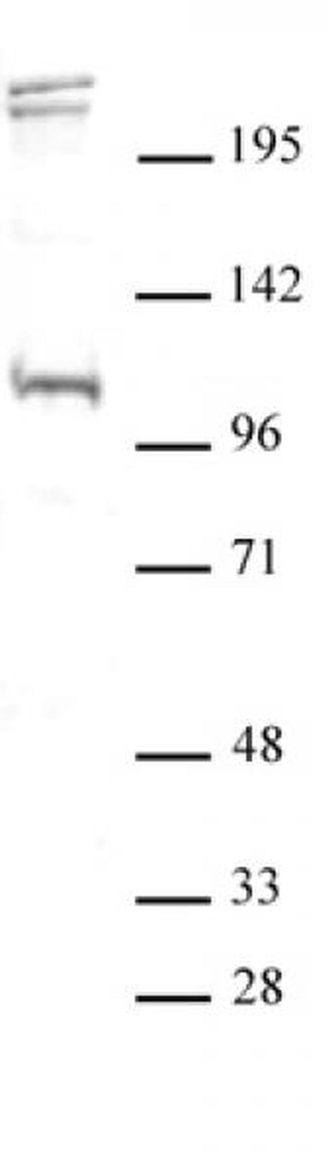 BLIMP1 / PRDM1 Antibody in Western Blot (WB)