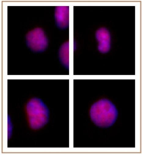 GATA-6 Antibody in Immunocytochemistry (ICC/IF)