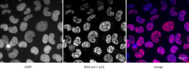 Phospho-RNA pol II CTD (Ser2) Antibody in Immunocytochemistry (ICC/IF)