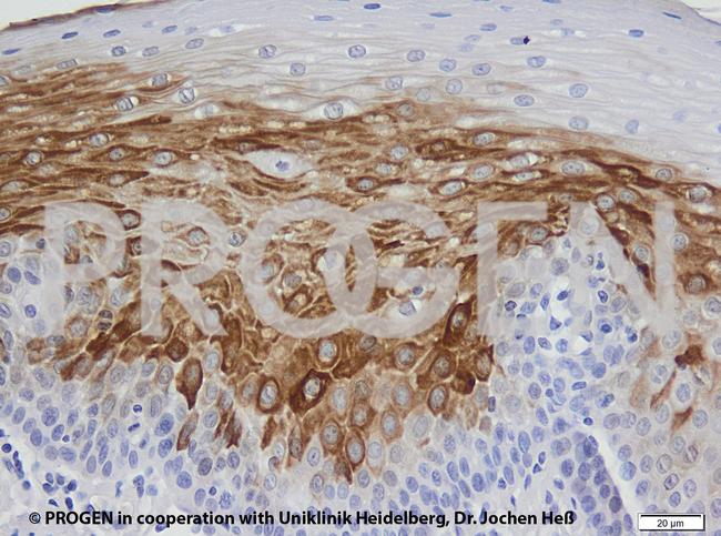 Cytokeratin 6 Antibody in Immunohistochemistry (IHC)