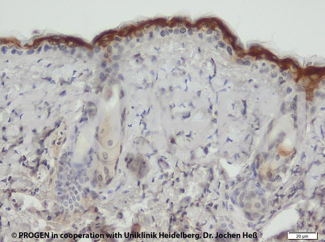 Cytokeratin 6 Antibody in Immunohistochemistry (IHC)