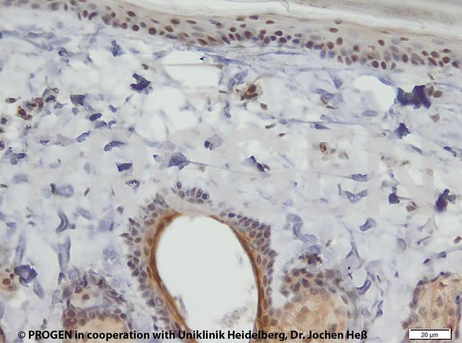 Cytokeratin 6 Antibody in Immunohistochemistry (IHC)