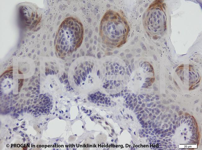 Cytokeratin 6 Antibody in Immunohistochemistry (IHC)