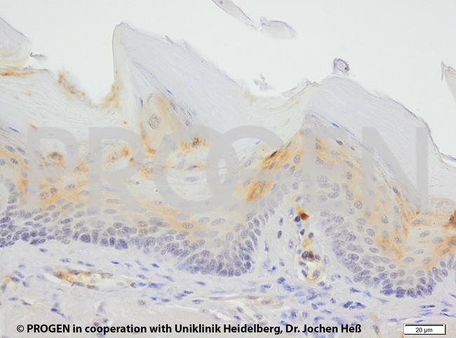 Cytokeratin 6 Antibody in Immunohistochemistry (IHC)