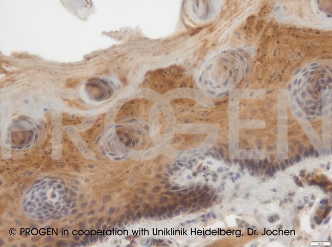 Desmocollin 3 Antibody in Immunohistochemistry (IHC)