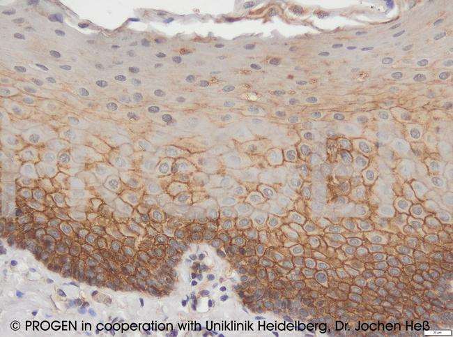 Desmocollin 3 Antibody in Immunohistochemistry (IHC)