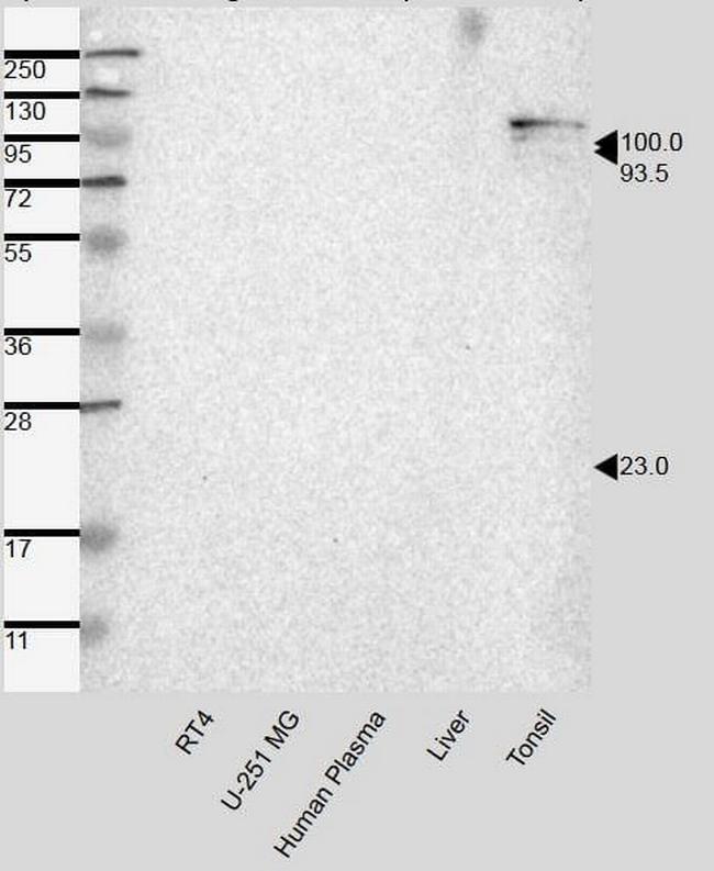 Desmocollin 3 Antibody in Western Blot (WB)