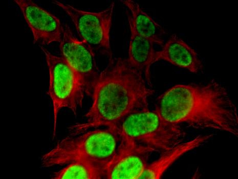 Histone H4K8ac Antibody in Immunocytochemistry (ICC/IF)