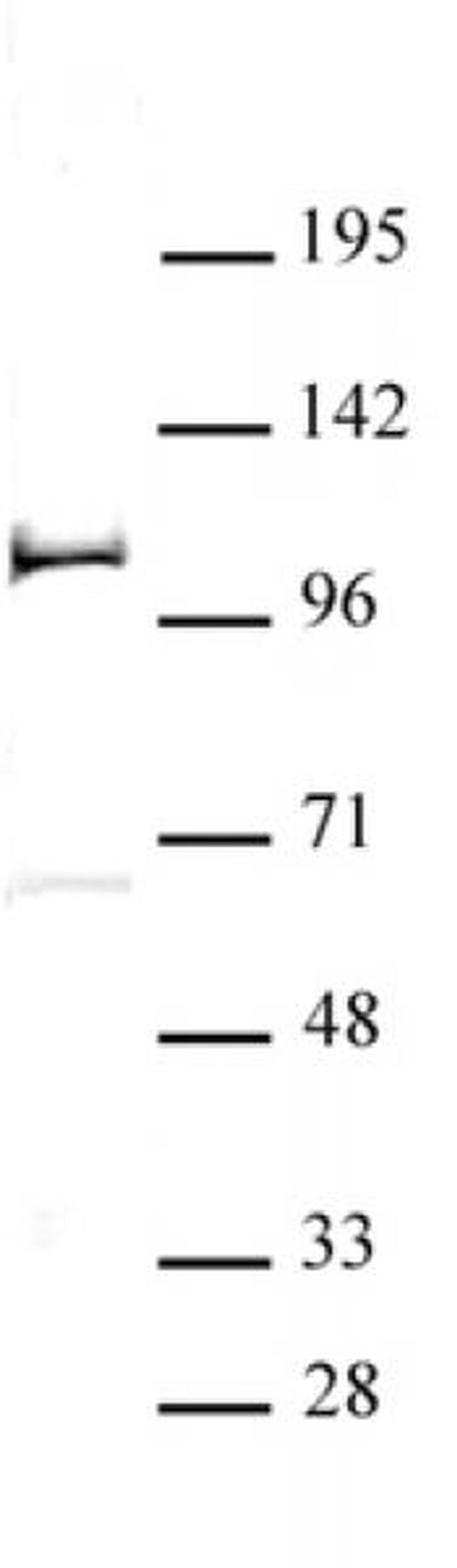 PHF20 Antibody in Western Blot (WB)