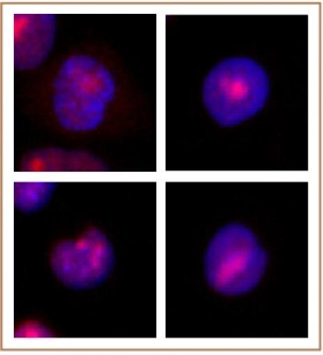 WRN Antibody in Immunocytochemistry (ICC/IF)