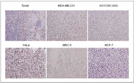 WRN Antibody in Immunohistochemistry (Paraffin) (IHC (P))