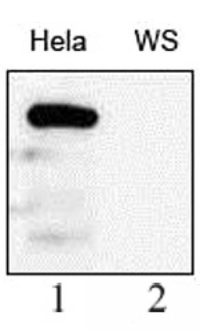 WRN Antibody in Western Blot (WB)