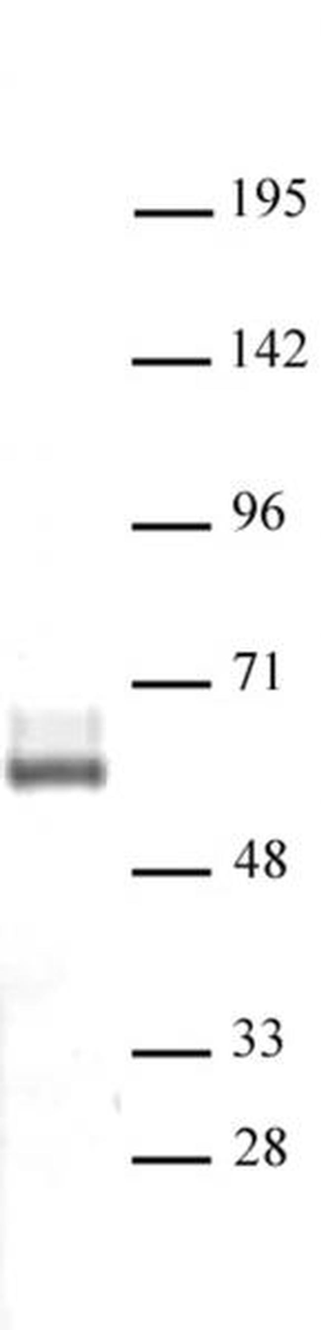 LXR-beta Antibody in Western Blot (WB)