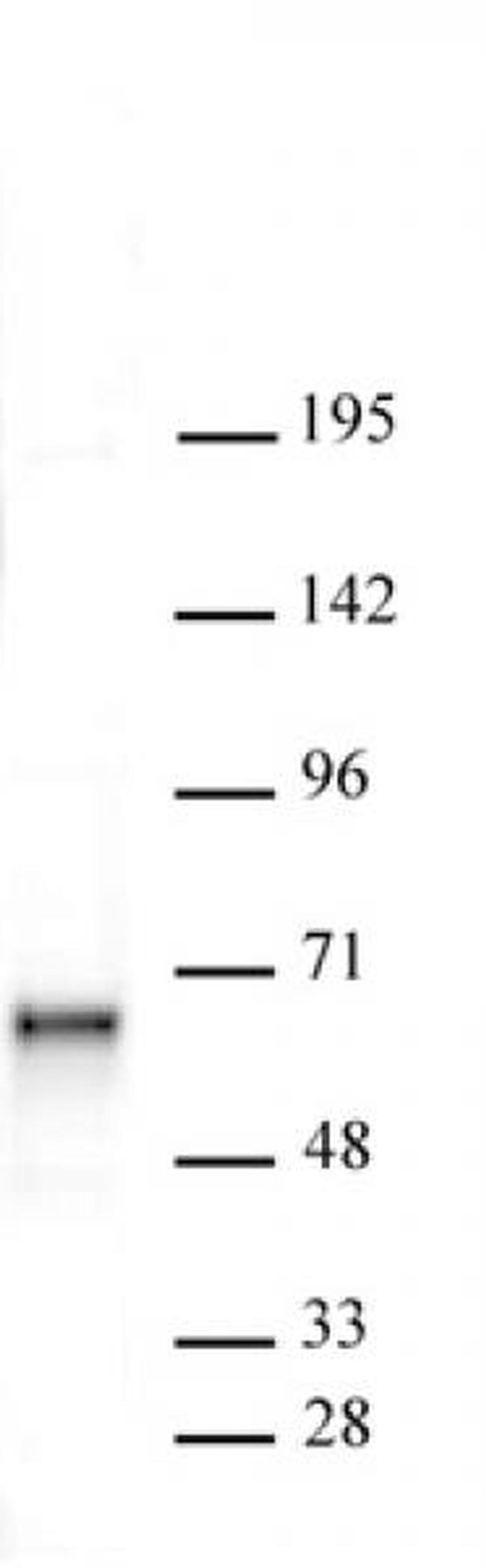 Sox11 Antibody in Western Blot (WB)