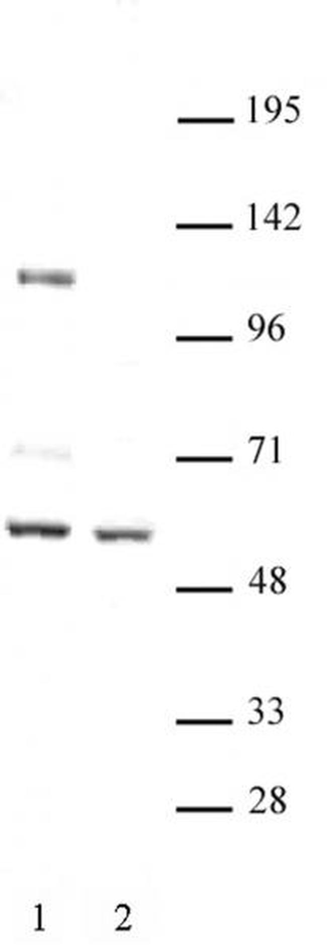 FOXG1 Antibody in Western Blot (WB)