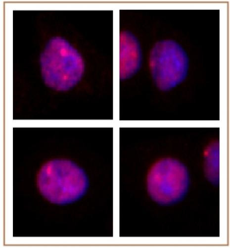 MLL / HRX Antibody in Immunocytochemistry (ICC/IF)