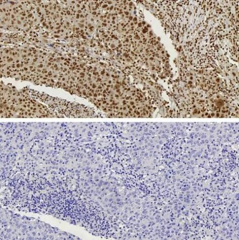 CTCF Antibody in Immunocytochemistry (ICC/IF)