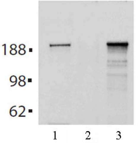 Tet2 Antibody in Immunoprecipitation (IP)