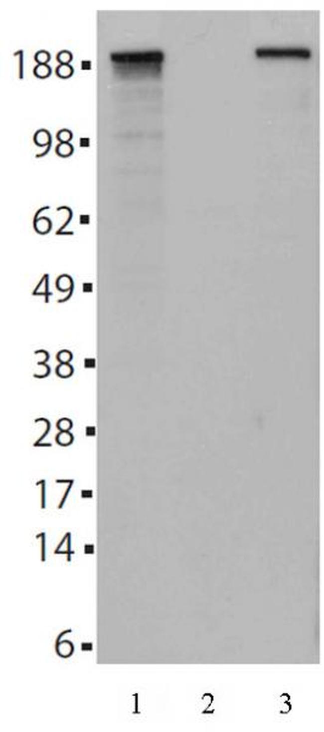 Tet2 Antibody in Western Blot (WB)