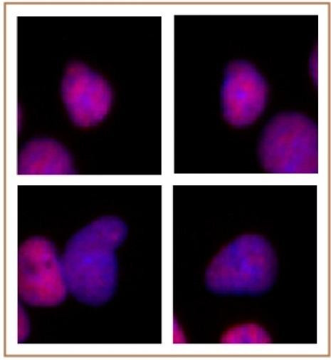 p300 Antibody in Immunocytochemistry (ICC/IF)