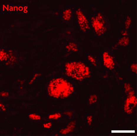 Nanog Antibody in Immunocytochemistry (ICC/IF)