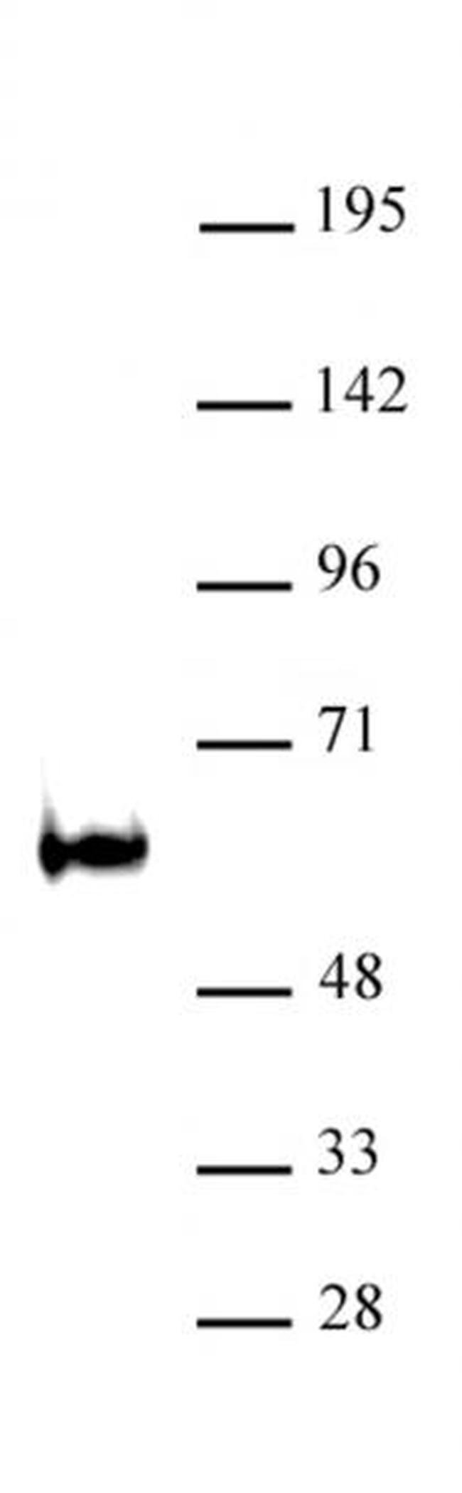 TDG / Thymine-DNA glycosylase Antibody in Western Blot (WB)