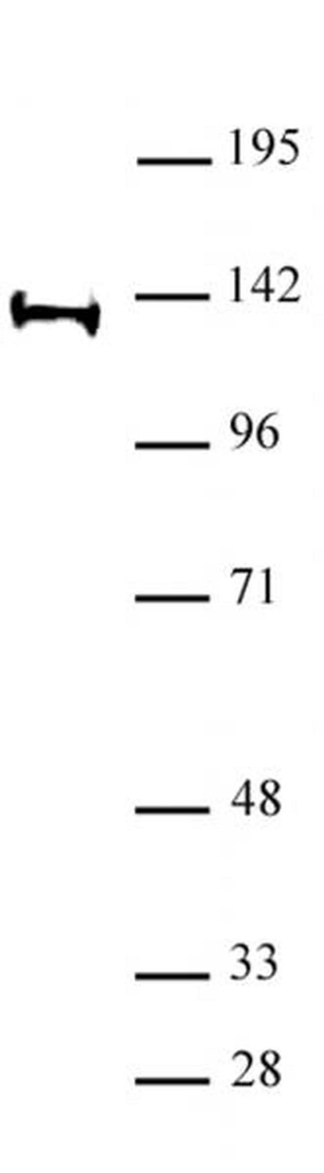 Supt16H / Spt16 Antibody in Western Blot (WB)