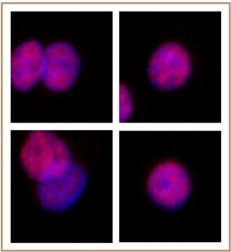 SMARCC2 / BAF170 Antibody in Immunocytochemistry (ICC/IF)