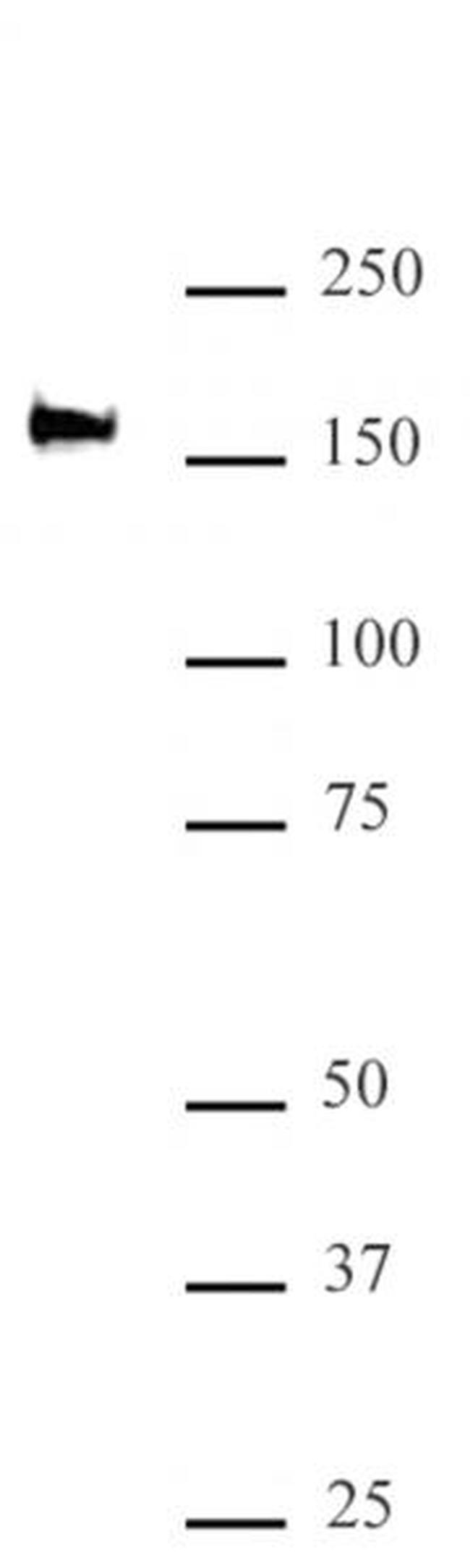 SMARCC2 / BAF170 Antibody in Western Blot (WB)