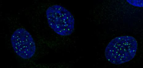 Phospho-CENP-A (Ser18) Antibody in Immunocytochemistry (ICC/IF)