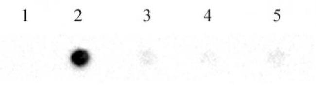 N6-Methyladenosine (m6A) Antibody in Dot Blot (DB)