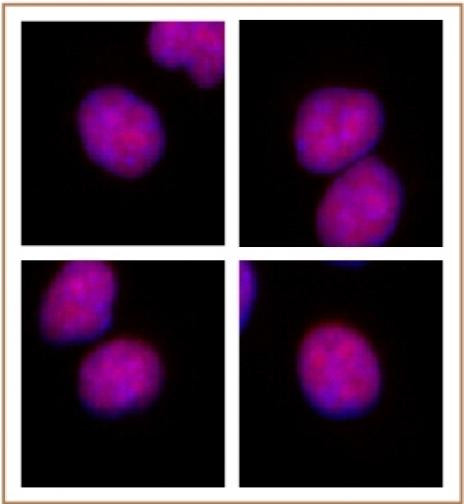 RBPJ Antibody in Immunocytochemistry (ICC/IF)