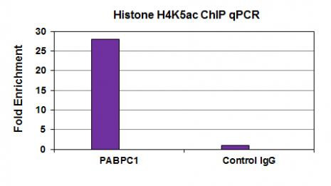 Histone H4K5ac Antibody in ChIP Assay (ChIP)