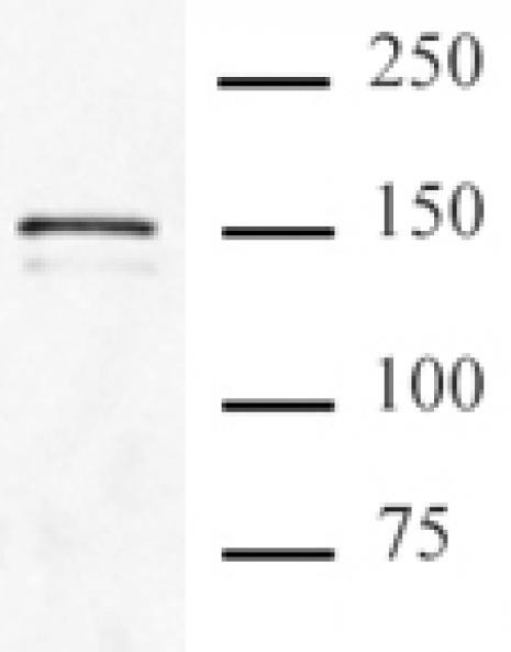 Cas9 Antibody in Immunoprecipitation (IP)