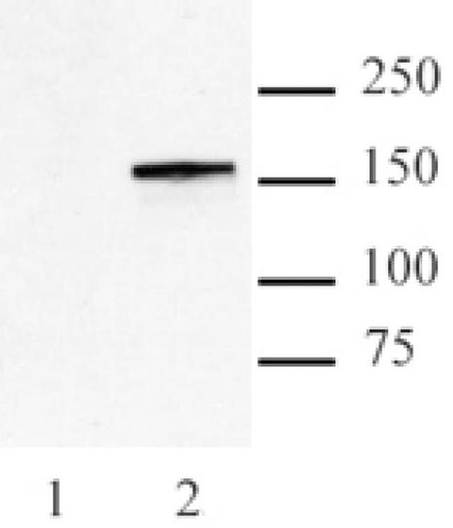 Cas9 Antibody in Western Blot (WB)