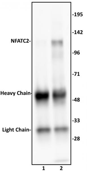 NFATC2 Antibody in Immunoprecipitation (IP)