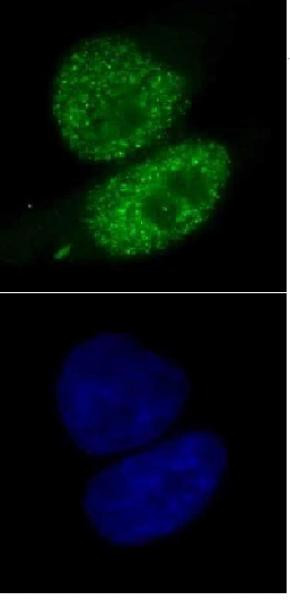 SMARCA4 Antibody in Immunocytochemistry (ICC/IF)