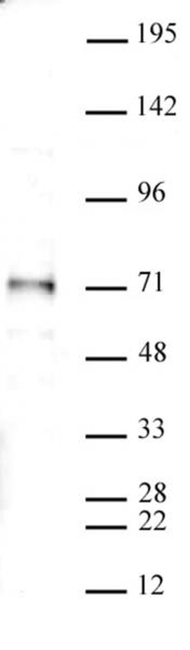 SMAD4 Antibody in Western Blot (WB)