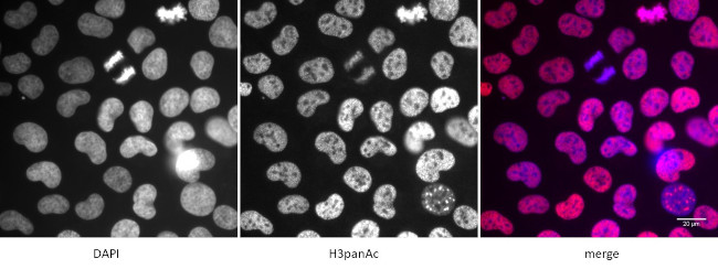 Histone H3ac (pan-acetyl) Antibody in Immunocytochemistry (ICC/IF)