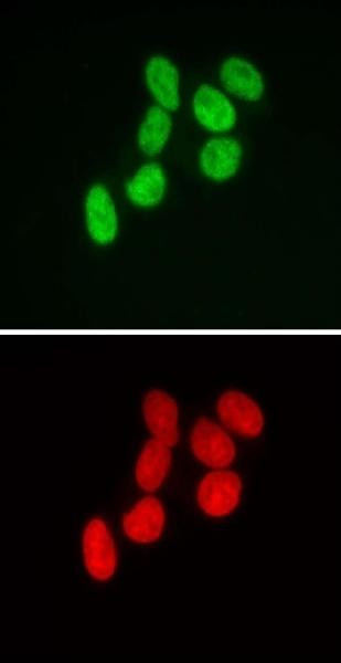 SMARCB1 Antibody in Immunocytochemistry (ICC/IF)