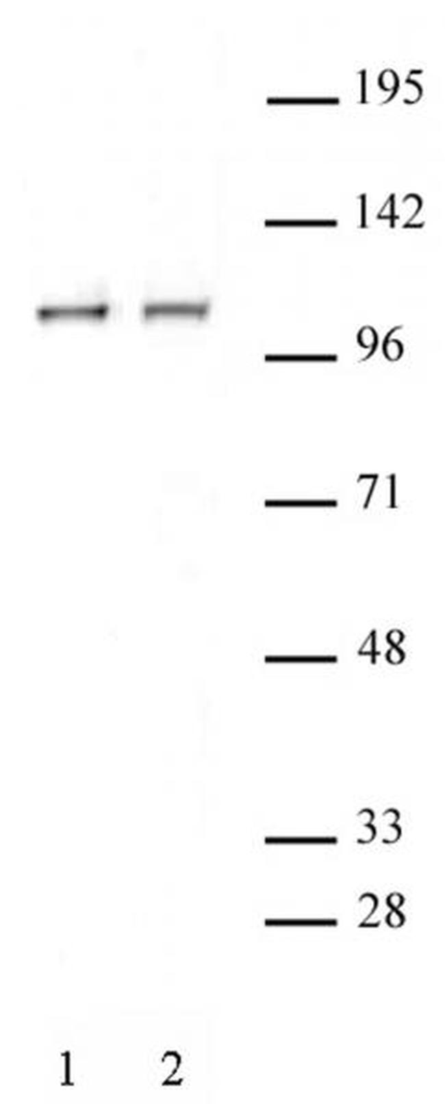 STAT2 Antibody in Western Blot (WB)