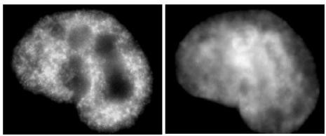 Histone H3K9ac Antibody in Immunocytochemistry (ICC/IF)