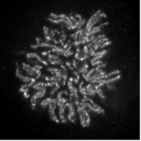 NCAPH2 Antibody in Immunocytochemistry (ICC/IF)