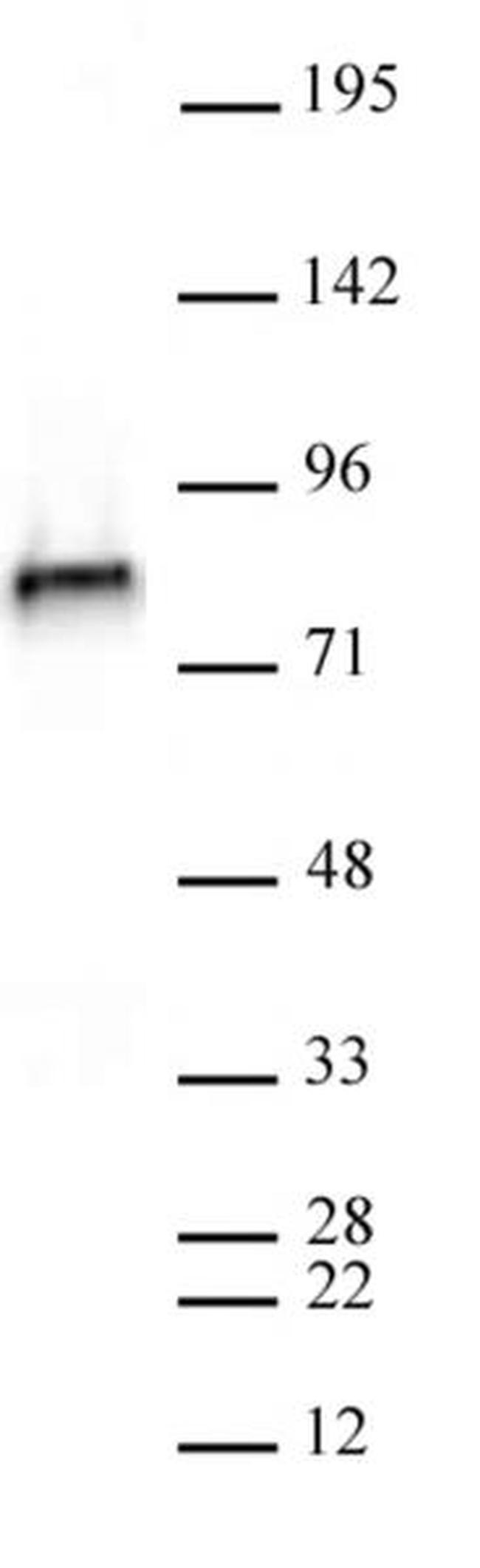 NCAPH2 Antibody in Western Blot (WB)