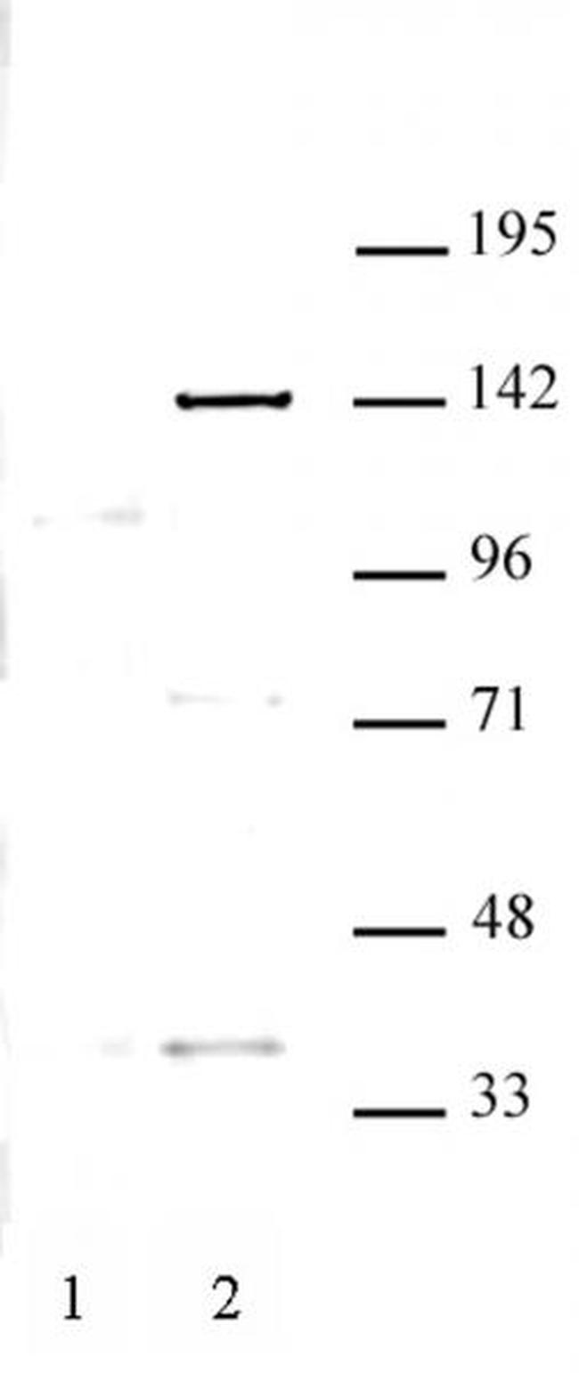 KDM4C Antibody in Western Blot (WB)